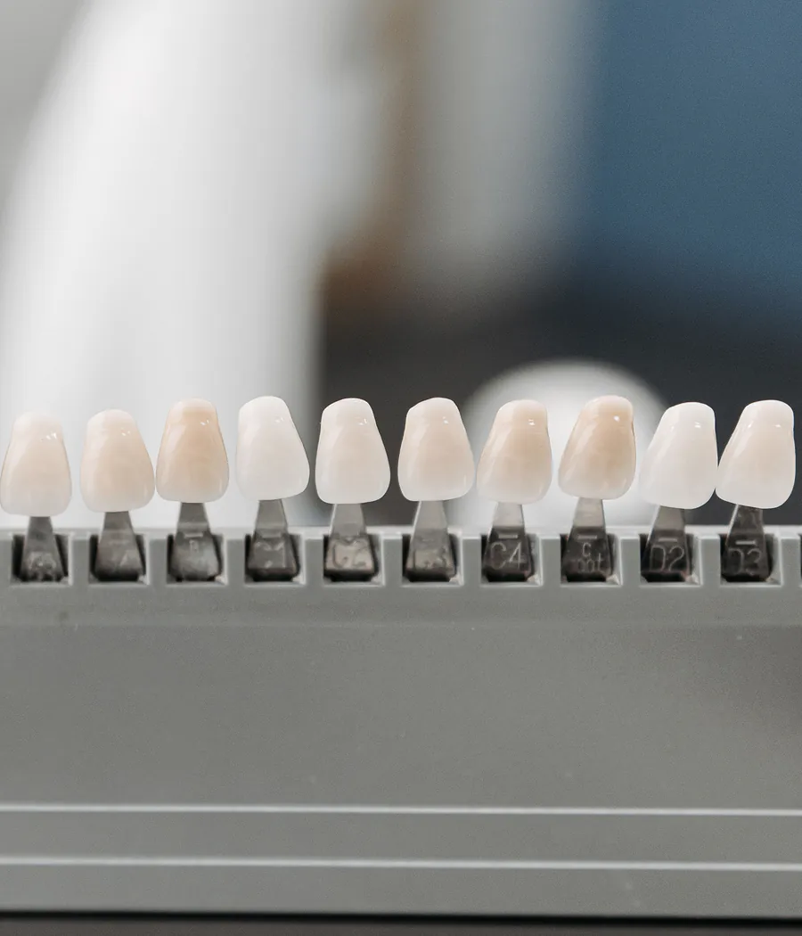 Dental veneer shade samples arranged for comparison